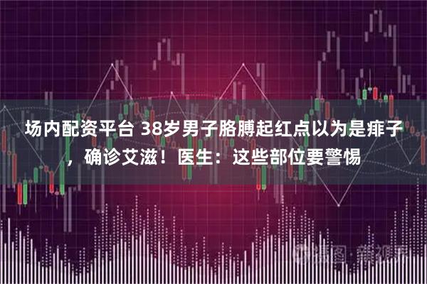 场内配资平台 38岁男子胳膊起红点以为是痱子，确诊艾滋！医生：这些部位要警惕